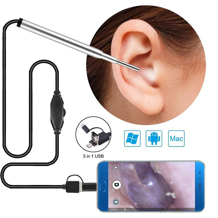 Igwefoto Endoscope Medical Ear imi Endoscope Usb Otoscope